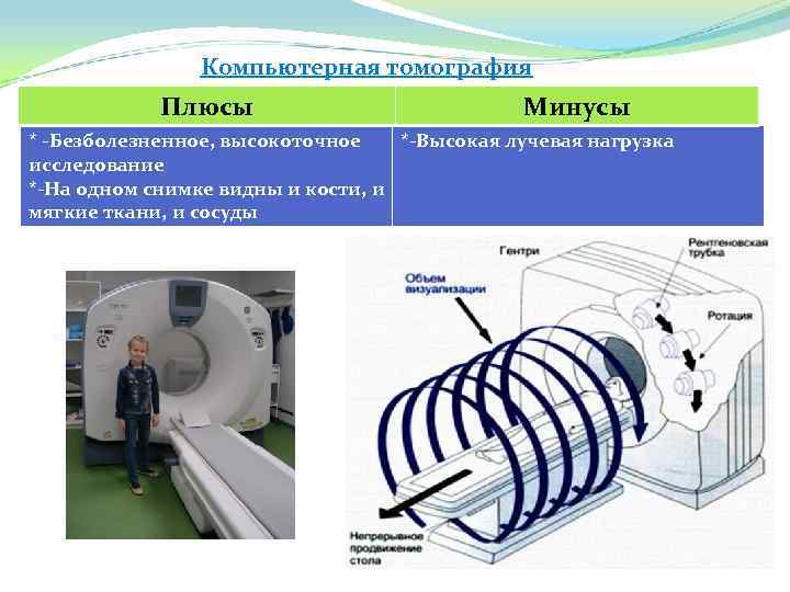 Компьютерная томография Плюсы Минусы * -Безболезненное, высокоточное *-Высокая лучевая нагрузка исследование *-На одном снимке