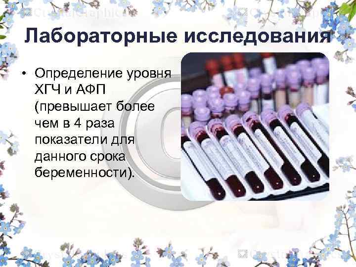 Лабораторные исследования • Определение уровня ХГЧ и АФП (превышает более чем в 4 раза