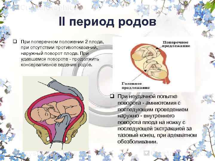 II период родов q При поперечном положении 2 плода, при отсутствии противопоказаний, наружный поворот