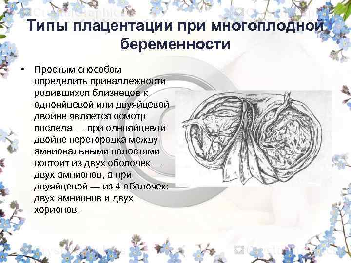 Типы плацентации при многоплодной беременности • Простым способом определить принадлежности родившихся близнецов к однояйцевой