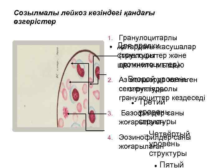 Созылмалы лейкоз кезіндегі қандағы өзгерістер 1. 2. Гранулоцитарлы Для правки қатардағы жасушалар структуры (миелоциттер