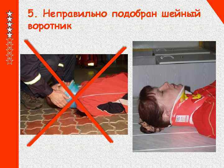 5. Неправильно подобран шейный воротник 