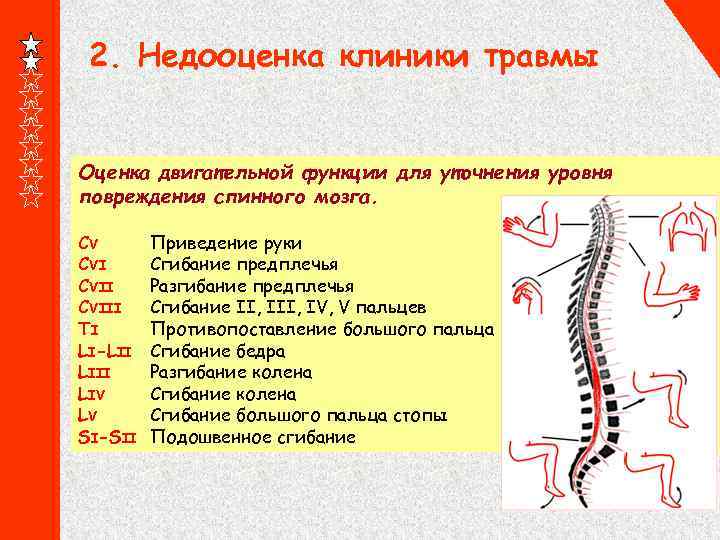 2. Недооценка клиники травмы Оценка двигательной функции для уточнения уровня повреждения спинного мозга. CV