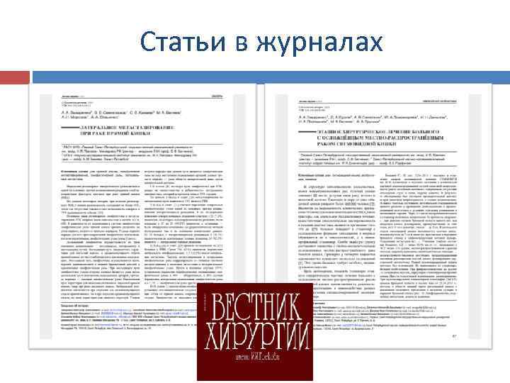 Статьи в журналах 