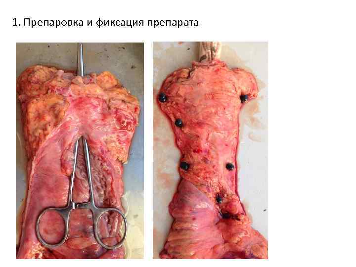 1. Препаровка и фиксация препарата 