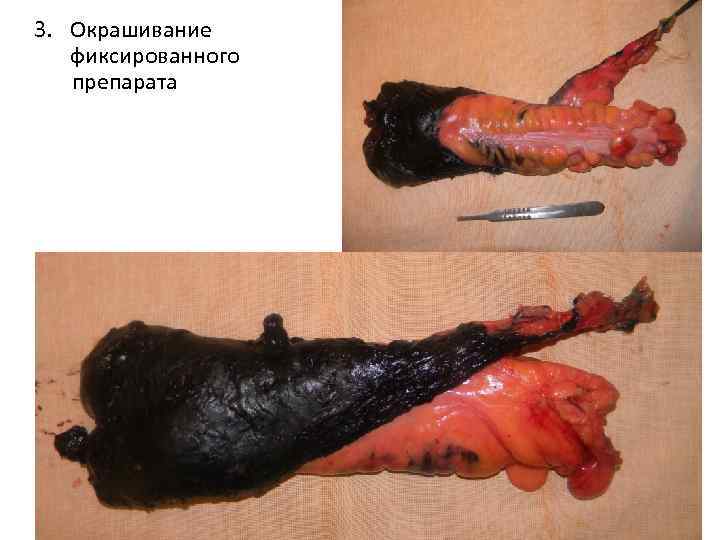 3. Окрашивание фиксированного препарата 