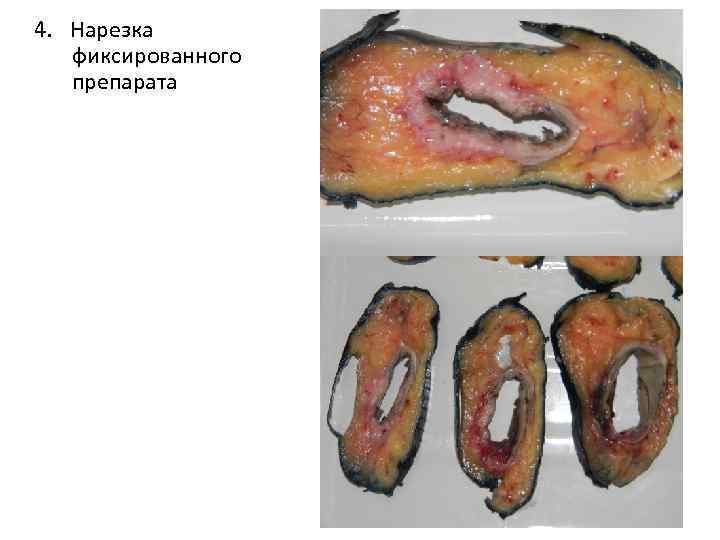 4. Нарезка фиксированного препарата 