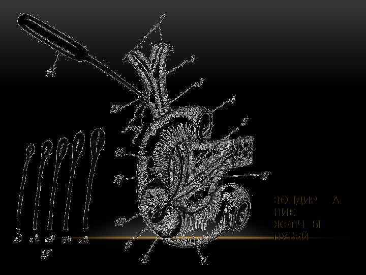 ЗОНДИРОВА НИЕ ЖЕЛЧНЫХ ПУТЕЙ 