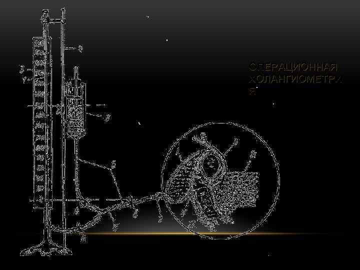 ОПЕРАЦИОННАЯ ХОЛАНГИОМЕТРИ Я 