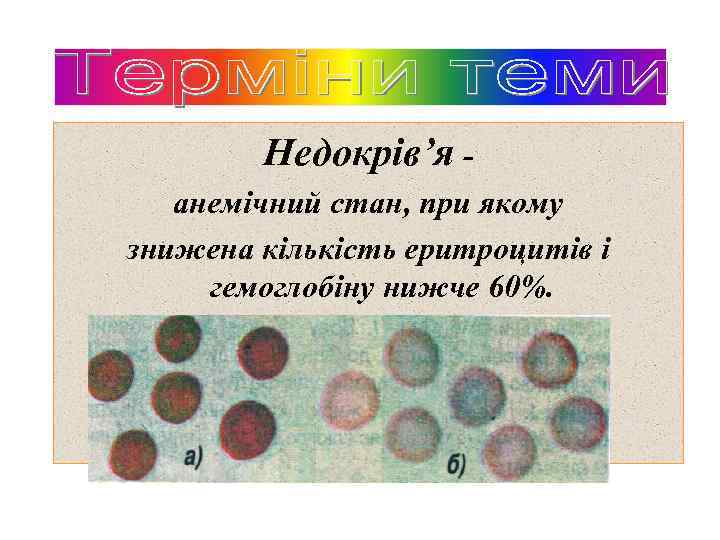 Недокрів’я анемічний стан, при якому знижена кількість еритроцитів і гемоглобіну нижче 60%. 