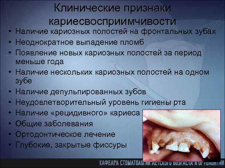 Клинические признаки кариесвосприимчивости • Наличие кариозных полостей на фронтальных зубах • Неоднократное выпадение пломб