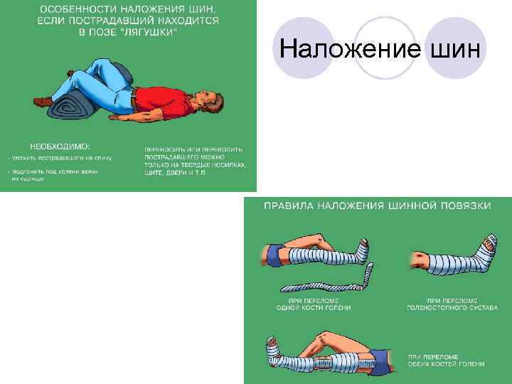 Наложение шин 