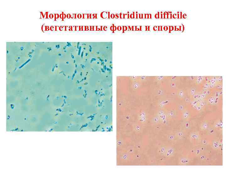 Морфология Clostridium difficile (вегетативные формы и споры) 