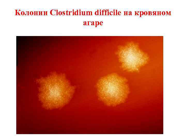 Колонии Clostridium difficile на кровяном агаре 