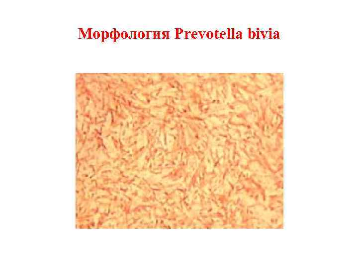 Морфология Prevotella bivia 
