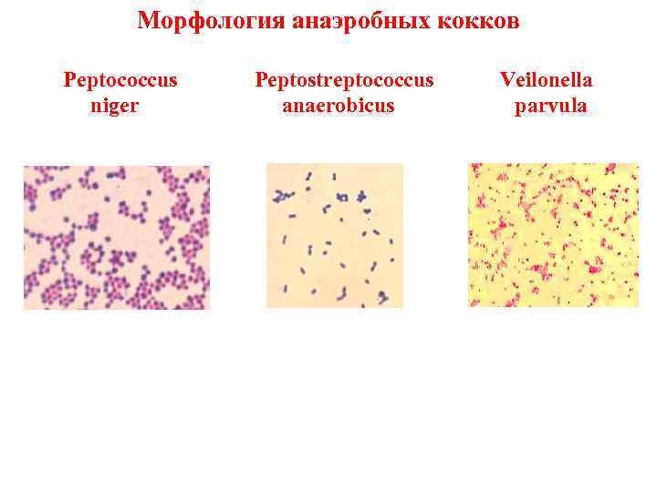 Морфология анаэробных кокков Peptococcus niger Peptostreptococcus anaerobicus Veilonella parvula 