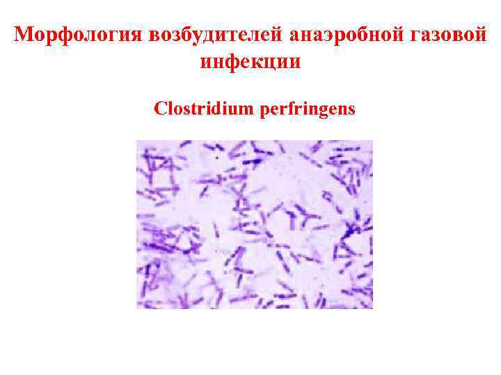 Морфология возбудителей анаэробной газовой инфекции Clostridium perfringens 
