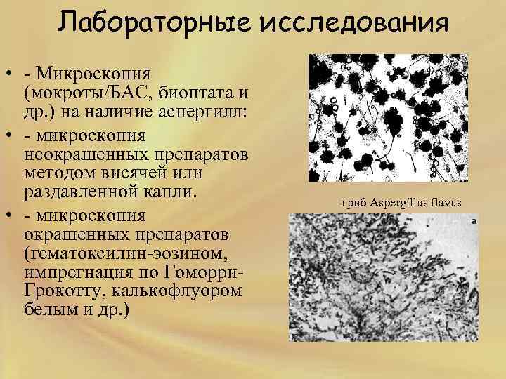 Микроскопия микробиология презентация