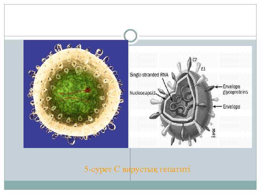 5 -сурет С вирустық гепатиті 