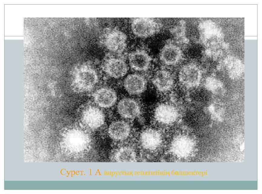 Сурет. 1 А вирустық гепатитінің бөлшектері 