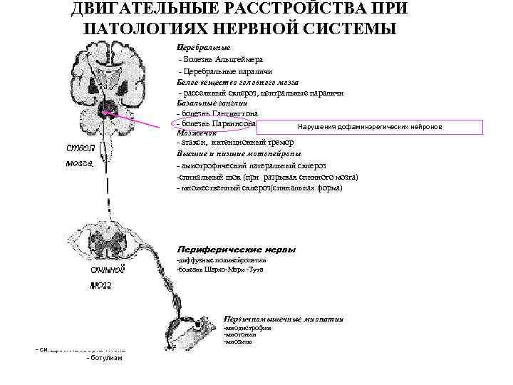 ДВИГАТЕЛЬНЫЕ РАССТРОЙСТВА ПРИ ПАТОЛОГИЯХ НЕРВНОЙ СИСТЕМЫ Церебральные - Болезнь Альцгеймера - Церебральные параличи Белое