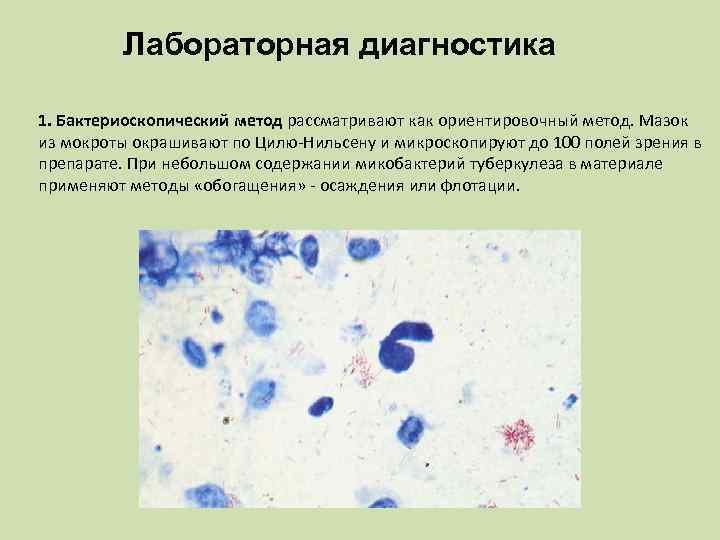 Лабораторная диагностика 1. Бактериоскопический метод рассматривают как ориентировочный метод. Мазок из мокроты окрашивают по