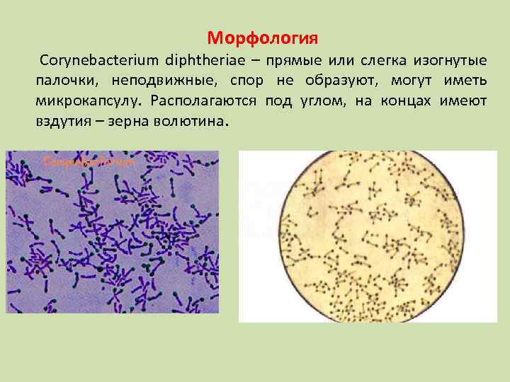 Морфология Corynebacterium diphtheriae – прямые или слегка изогнутые палочки, неподвижные, спор не образуют, могут