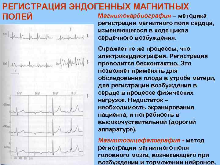 РЕГИСТРАЦИЯ ЭНДОГЕННЫХ МАГНИТНЫХ Магнитокардиография – методика ПОЛЕЙ регистрации магнитного поля сердца, изменяющегося в ходе