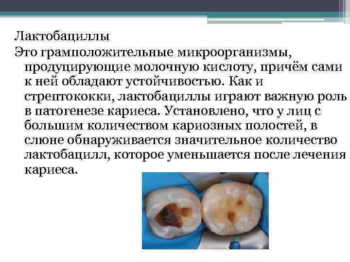 Лактобациллы Это грамположительные микроорганизмы, продуцирующие молочную кислоту, причём сами к ней обладают устойчивостью. Как