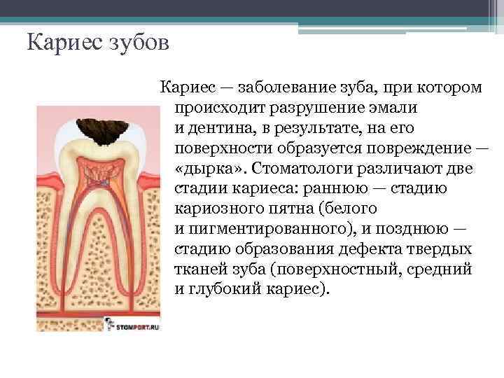 Заболевания зубов и полости. Кариозное поражение зуба. Средний кариес презентация.