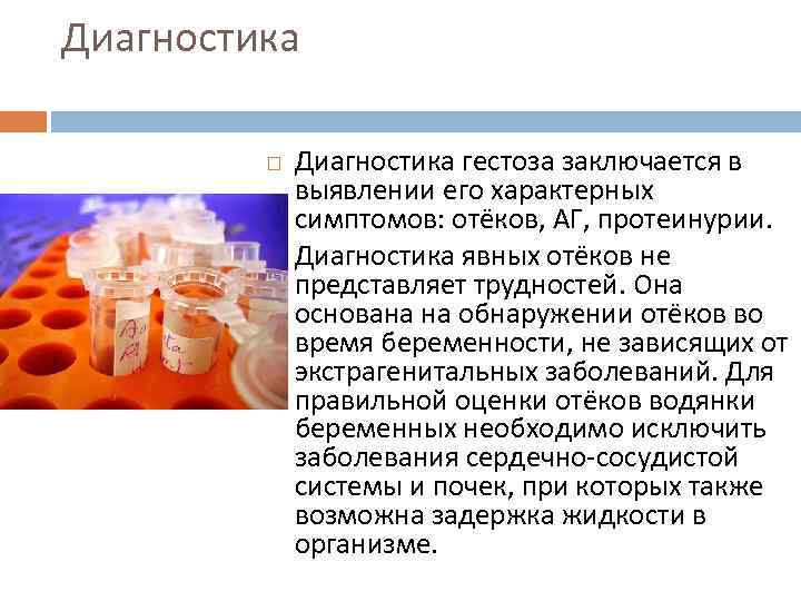 Диагностика гестоза заключается в выявлении его характерных симптомов: отёков, АГ, протеинурии. Диагностика явных отёков
