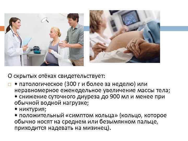 О скрытых отёках свидетельствует: • патологическое (300 г и более за неделю) или неравномерное