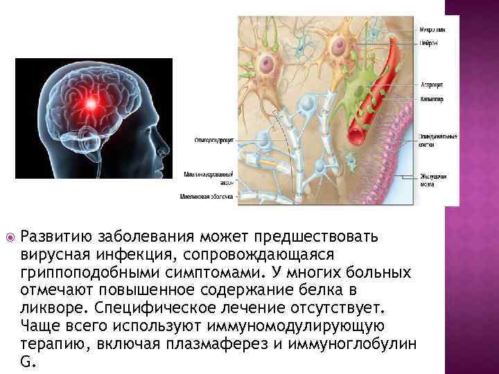  Развитию заболевания может предшествовать вирусная инфекция, сопровождающаяся гриппоподобными симптомами. У многих больных отмечают