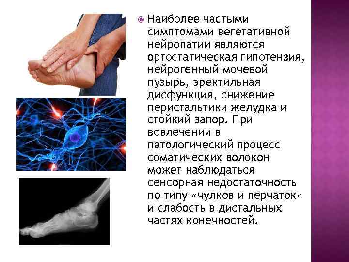 Нейропатия пальцев. Периферическая сенсорная нейропатия. Наиболее частой причиной ортостатической гипотензии является. Вегетативная нейропатия. Сенсорная недостаточность.