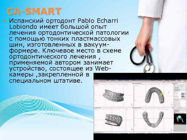 CA-SMART Испанский ортодонт Pablo Echarri Lobiondo имеет большой опыт лечения ортодонтической патологии с помощью