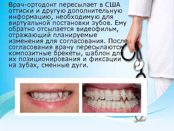  Врач-ортодонт пересылает в США оттиски и другую дополнительную информацию, необходимую для виртуальной постановки