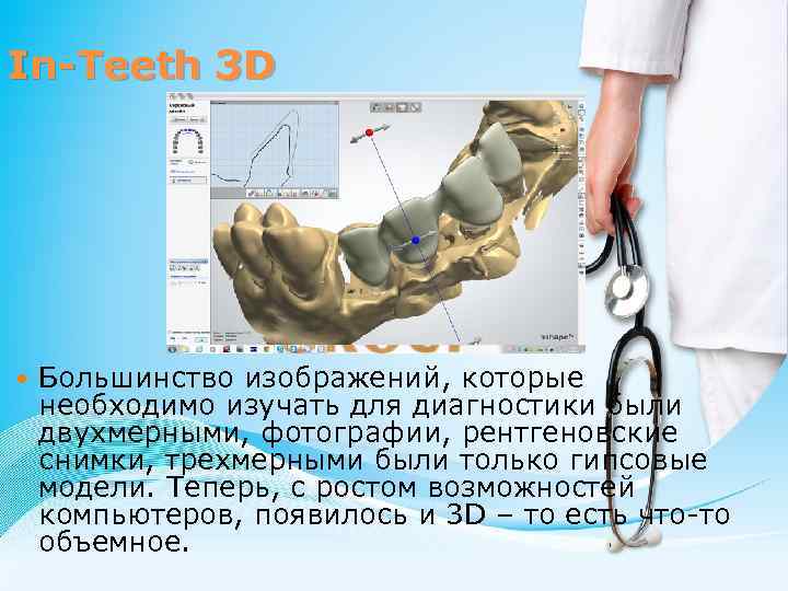 In-Teeth 3 D Большинство изображений, которые необходимо изучать для диагностики были двухмерными, фотографии, рентгеновские