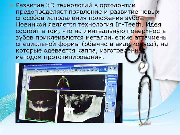  Развитие 3 D технологий в ортодонтии предопределяет появление и развитие новых способов исправления