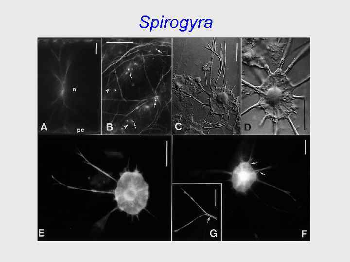 Spirogyra 