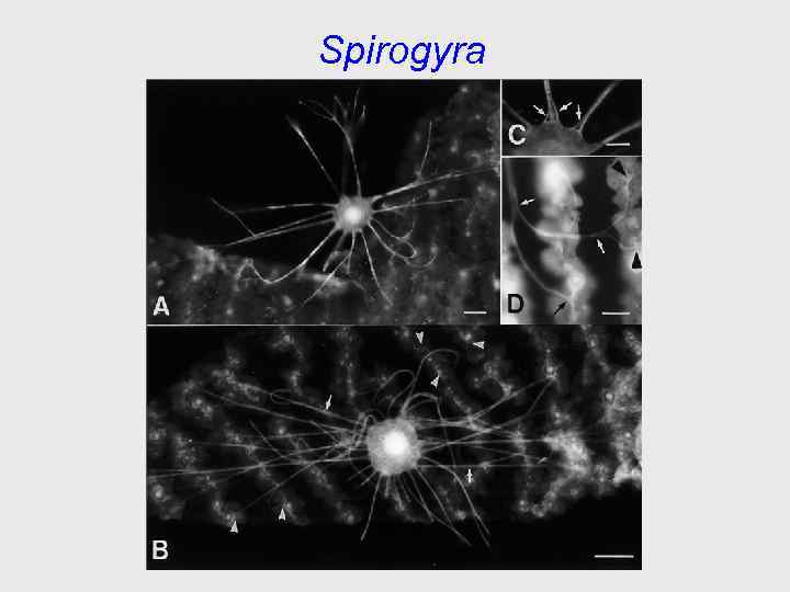 Spirogyra 