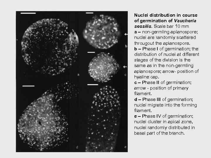 Nuclei distribution in course of germination of Vaucheria sessilis. Scale bar 10 mm a