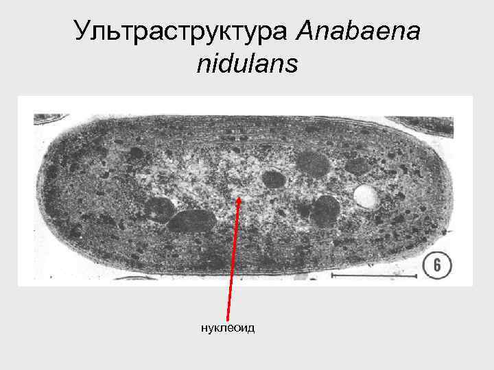 Нуклеоид прокариот. Нуклеоид строение и функции. Нуклеоид бактериальной клетки. Нуклеоид микрофотография. Нуклеоид бактерий строение.