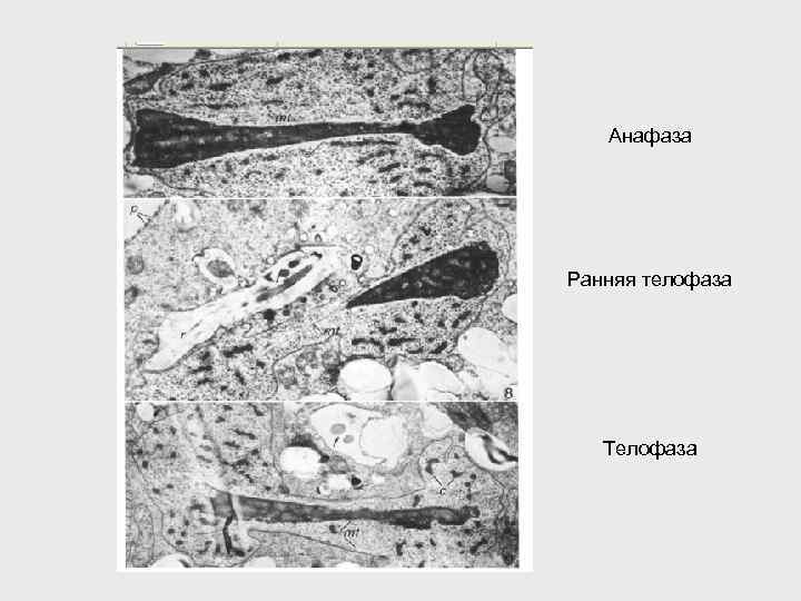 Анафаза Ранняя телофаза Телофаза 