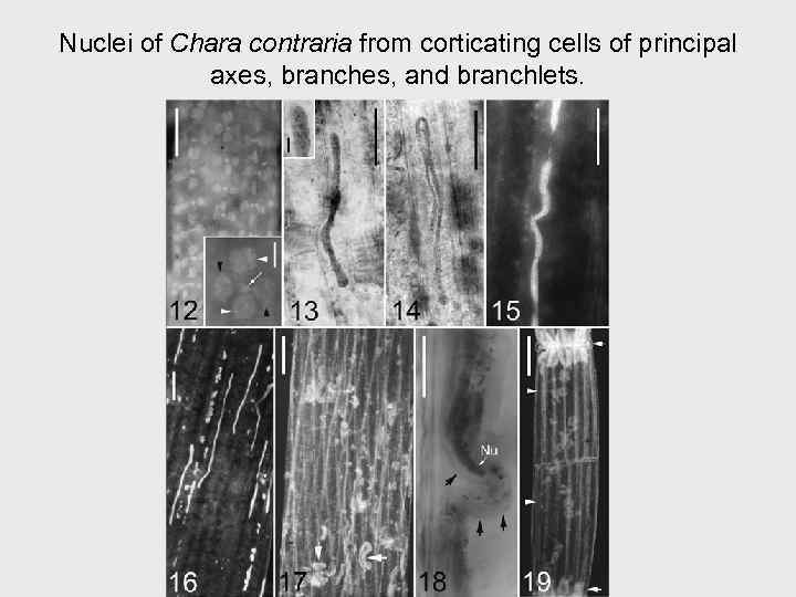 Nuclei of Chara contraria from corticating cells of principal axes, branches, and branchlets. 