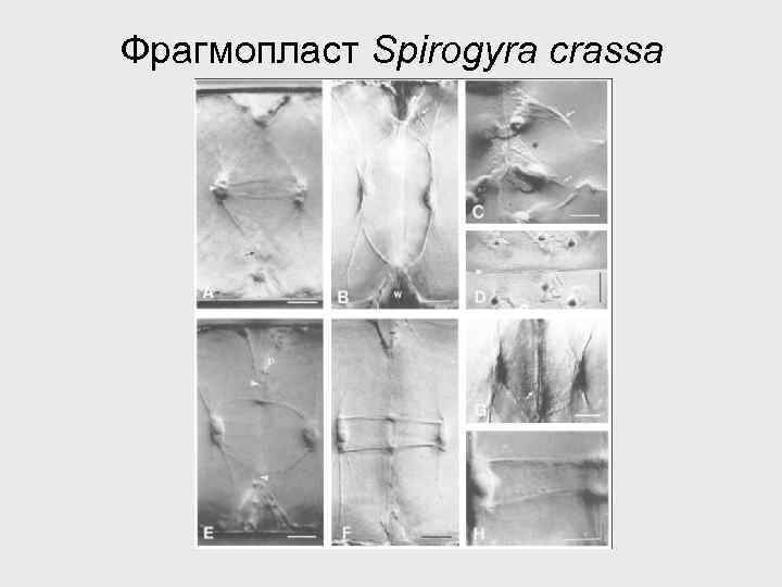 Фрагмопласт Spirogyra crassa 