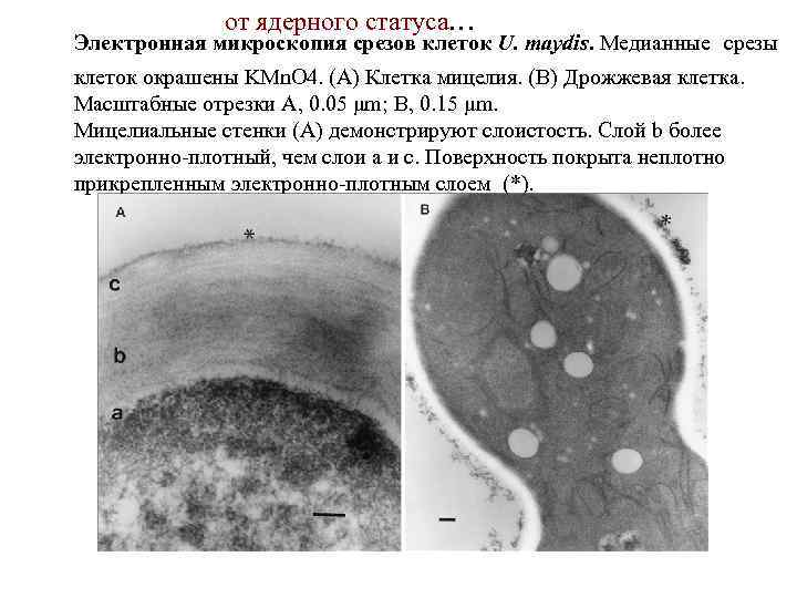 Из чего состоит стенка грибов. Клеточная стенка грибов хитин. Микрофотография грибной клетки. Структура клеточной стенки гриба. Клетка гриба стенка.