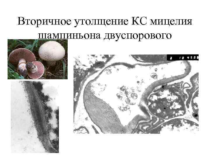 Вторичное утолщение КС мицелия шампиньона двуспорового 