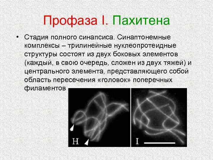 Профаза I. Пахитена • Стадия полного синапсиса. Синаптонемные комплексы – трилинейные нуклеопротеидные структуры состоят