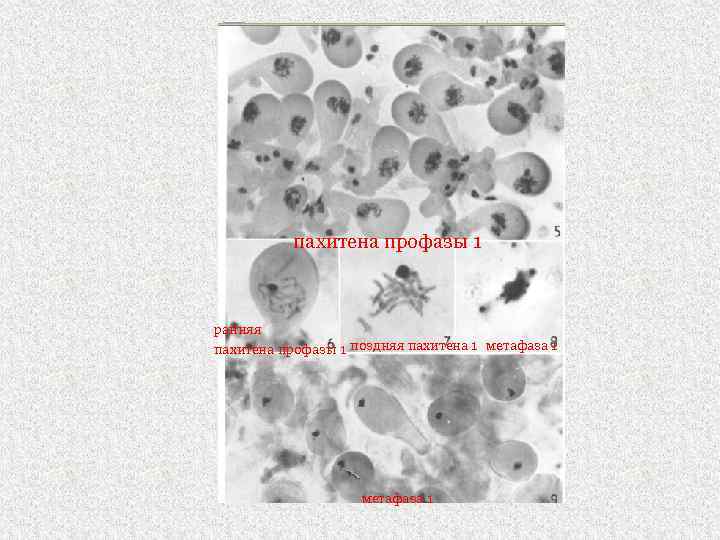 пахитена профазы 1 ранняя пахитена профазы 1 поздняя пахитена 1 метафаза 1 
