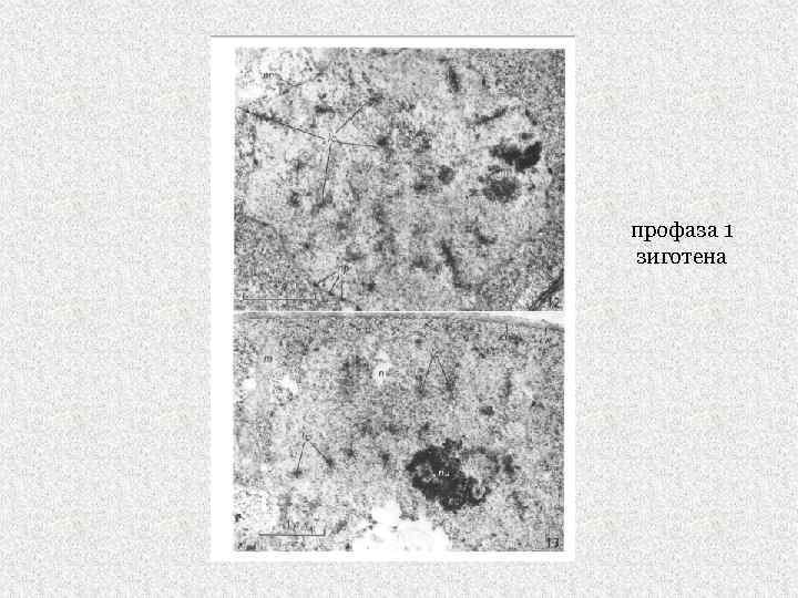 профаза 1 зиготена 
